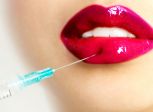 Juvederm